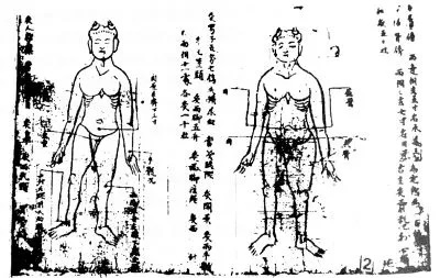敦煌卷子中的针灸图，原卷藏于英国伦敦博物馆。.jpg